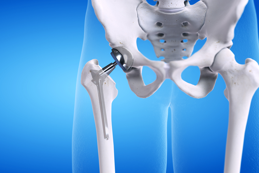 Human pelvis and hip bone anatomy illustration showing hip joint and femur connection.